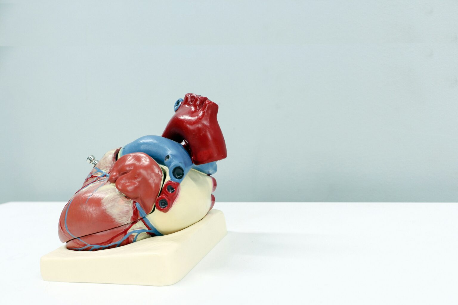 Heart - Ascites