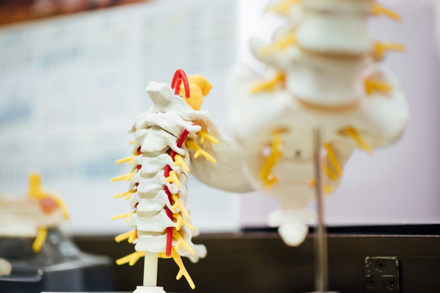 Scoliosis