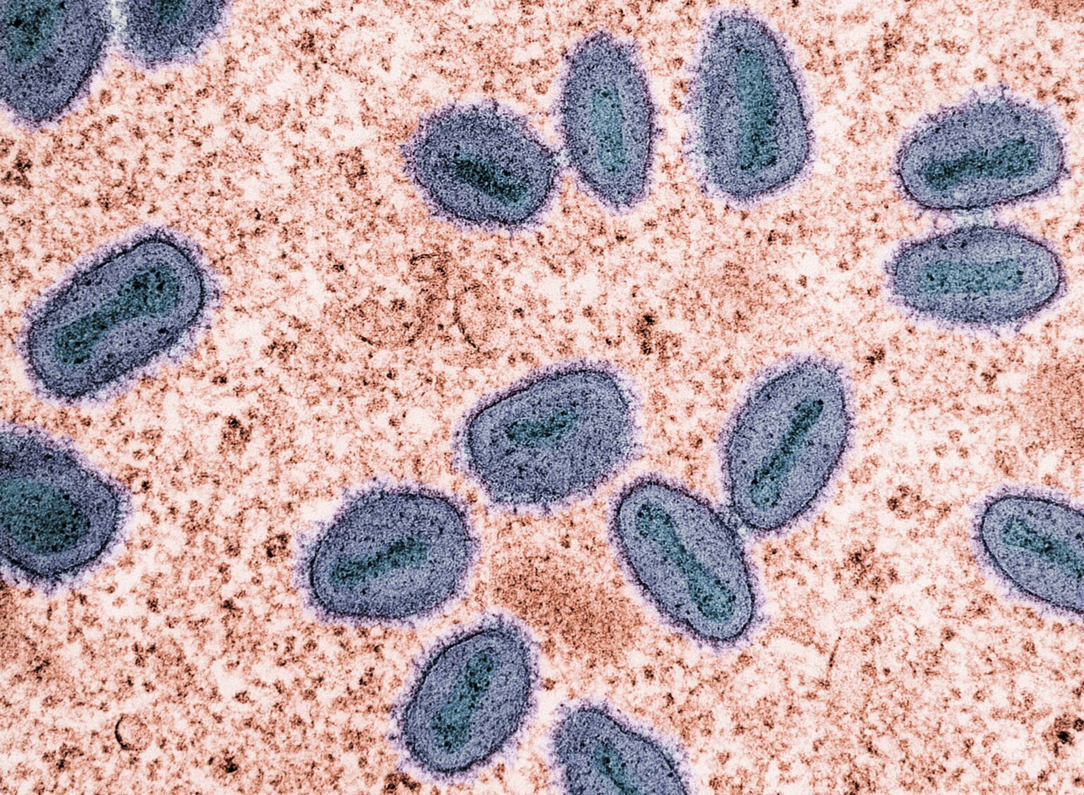 national-institute-of-allergy-and-infectious-diseases-XDfN0kKFE7M-unsplash